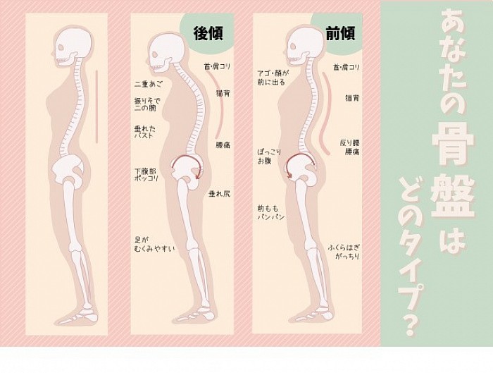 骨盤女性　姿勢　正しい　反り腰　下腹　ぽっこり　猫背　お尻の垂れ　二重顎　バスト　垂れる　ふくらはぎ　ガチガチ　首肩のこり　痛み　姿勢が悪い　背骨　腰　首