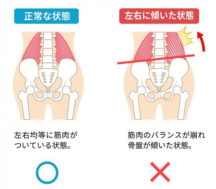 骨盤の歪み、女性、お尻の垂れ、くびれ、ヒップライン、姿勢、モデル、綺麗、30代、40代、50代、脂肪、たるみ