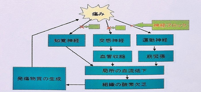 痛みの悪循環